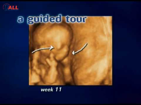 Baby Steps: 4D Ultrasound
